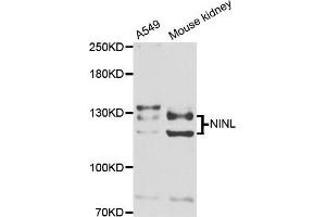 Western blot analysis of extracts of A549 and mouse kidney cell lines, using NINL antibody. (NINL antibody)