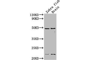 anti-Epidermal Growth Factor Receptor a (Erythroblastic Leukemia Viral (V-Erb-B) Oncogene Homolog, Avian) (EGFRA) (AA 21-389) antibody