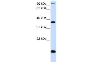 WB Suggested Anti-KLF8 Antibody Titration: 0. (KLF8 antibody  (N-Term))