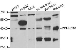 Western blot analysis of extracts of various cell lines, using ZDHHC16 antibody. (ZDHHC16 antibody)