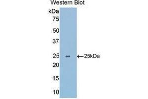 Western Blotting (WB) image for anti-Slit Homolog 1 (SLIT1) (AA 3-211) antibody (ABIN1176119) (SLIT1 antibody  (AA 3-211))