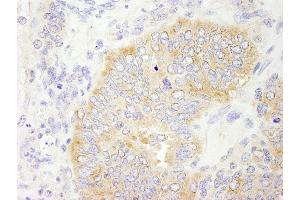 Immunohistochemistry (IHC) image for anti-eIF2beta/EIF2S2 (AA 283-333) antibody (ABIN7448545) (eIF2beta/EIF2S2 (AA 283-333) antibody)