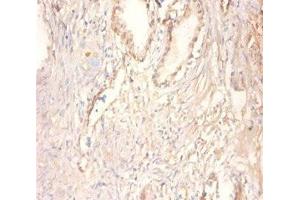 Immunohistochemistry of paraffin-embedded human prostate tissue using ABIN7148667 at dilution of 1:100 (CKMT1A antibody  (AA 40-417))