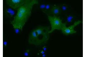 Anti-MOBKL2B mouse monoclonal antibody (ABIN2453319) immunofluorescent staining of COS7 cells transiently transfected by pCMV6-ENTRY MOBKL2B (RC205977). (MOBKL2B antibody)