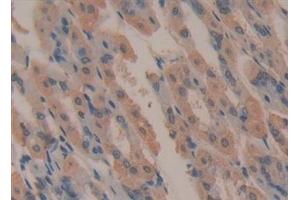 Immunohistochemistry (IHC) image for anti-Complement 4 (C4) (AA 1450-1723) antibody (ABIN7432859)