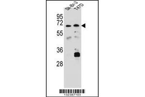 Western blot analysis in Sk-Br-3,T47D cell line lysates (35ug/lane). (CES4A antibody  (C-Term))