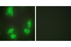 Peptide - +Western blot analysis of extracts from rat brain cells, using CDK5R1 antibody. (CDK5R1 antibody)