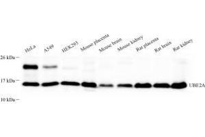 Western blot analysis of UBE2A (ABIN7075356) at dilution of 1: 500 (Rad6 antibody)