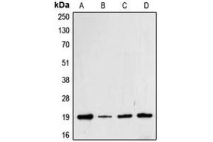 Western blot analysis of Cofilin (pS3) expression in Jurkat (A), HeLa (B), MCF7 (C), A431 (D) whole cell lysates. (Cofilin antibody  (N-Term, pSer3))