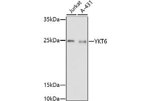 Western blot analysis of extracts of various cell lines, using YKT6 antibody (ABIN7271424) at 1:1000 dilution.