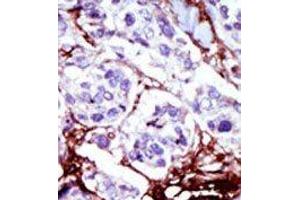 Image no. 2 for anti-Cytidine Monophosphate (UMP-CMP) Kinase 1, Cytosolic (CMPK1) (C-Term) antibody (ABIN360614) (Cytidine Monophosphate (UMP-CMP) Kinase 1, Cytosolic (CMPK1) (C-Term) antibody)