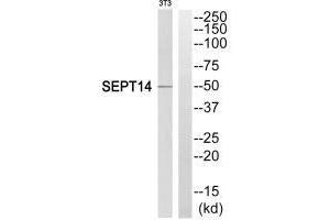 Western blot analysis of extracts from NIH/3T3 cells, using SEPT14 antibody. (Septin 14 antibody  (C-Term))