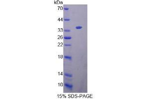 SDS-PAGE analysis of Mouse KEL Protein. (KEL Protein)
