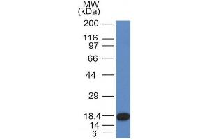 Image no. 1 for anti-Mast/stem Cell Growth Factor Receptor (KIT) (AA 100-300) antibody (ABIN6190751) (KIT antibody  (AA 100-300))
