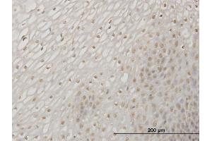 Immunoperoxidase of monoclonal antibody to ERN1 on formalin-fixed paraffin-embedded human esophagus. (ERN1 antibody  (AA 401-500))