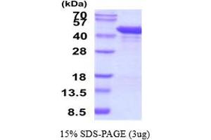 Matrix Metallopeptidase 1 (Interstitial Collagenase) (MMP1) (AA 100-469) protein (His tag)