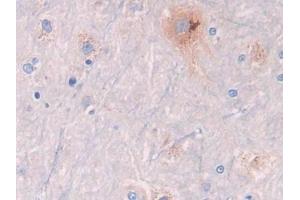 DAB staining on IHC-P; Samples: Rat Spinal cord Tissue (GLB1 antibody  (AA 338-570))