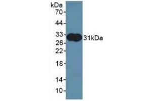 Detection of Recombinant ALDOA, Rat using Polyclonal Antibody to Aldolase A, Fructose Bisphosphate (ALDOA) (ALDOA antibody)