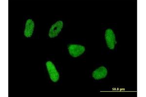 Immunofluorescence of purified MaxPab antibody to RNF168 on HeLa cell. (RNF168 antibody  (AA 1-571))