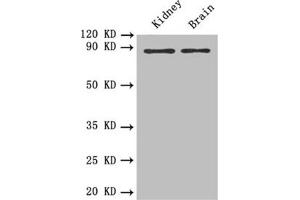 Western blot All lanes: PTPRE antibody at 0. (PTPRE antibody)
