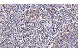 Detection of CXCL2 in Human Spleen Tissue using Polyclonal Antibody to Chemokine (C-X-C Motif) Ligand 2 (CXCL2) (CXCL2 antibody  (AA 34-107))