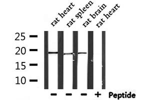 Western blot analysis of extracts from rat heart ,rat spleen and rat brain, using PTP4A3 Antibody. (PTP4A3 antibody  (C-Term))