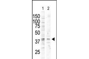 The anti-P38delta C-term Pab (ABIN6242133 and ABIN6578997) is used in Western blot to detect P38 delta in nocodazole-treated HC (lane 1) and A-treated Pam212 (lane 2) cell lysates. (MAPK13 antibody  (C-Term))