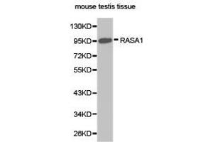 Western Blotting (WB) image for anti-RAS P21 Protein Activator (GTPase Activating Protein) 1 (RASA1) antibody (ABIN1874554)
