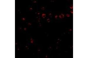 Immunofluorescence of Integrin alpha 4 in Jurkat cells with AP30435PU-N Integrin alpha 4 antibody at 2 μg/ml. (ITGA4 antibody  (Center))