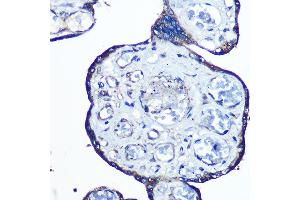 Immunohistochemistry of paraffin-embedded human placenta using N-WASP/N-WASP/WASL Rabbit mAb (ABIN7268856) at dilution of 1:100 (40x lens). (Neural Wiskott-Aldrich syndrome protein (WASL) antibody)