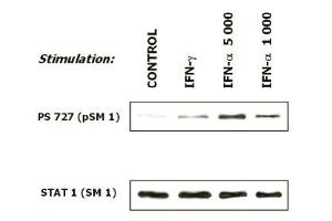 Induction of phosphorylation of STAT 1 at Ser727 in human malignant melanoma cells (short-term culture derived from a patient) in response to interferons. (STAT1 antibody  (pSer727))