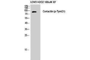 Western Blotting (WB) image for anti-Cortactin (CTTN) (pTyr421) antibody (ABIN3181971) (Cortactin antibody  (pTyr421))