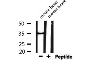 Western blot analysis of extracts from mouse heart, using ARG1 Antibody. (Liver Arginase antibody  (C-Term))