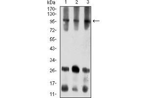 Western Blotting (WB) image for anti-Ataxin 1 (ATXN1) (AA 645-815) antibody (ABIN7193320)