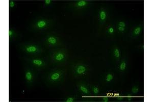 Immunofluorescence (IF) image for anti-SMAD, Mothers Against DPP Homolog 3 (SMAD3) (AA 1-110) antibody (ABIN561720)