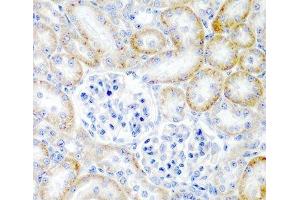 Immunohistochemistry of paraffin-embedded Rat kidney using RLN2 Polyclonal Antibody at dilution of 1:200 (40x lens). (Relaxin 2 antibody)