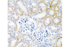 Immunohistochemistry of paraffin-embedded Rat kidney using RLN2 Polyclonal Antibody at dilution of 1:200 (40x lens). (Relaxin 2 antibody)