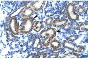 Rabbit Anti-FLJ14768 Antibody Catalog Number: ARP30009 Paraffin Embedded Tissue: Human Kidney Cellular Data: Epithelial cells of renal tubule Antibody Concentration: 4. (FIZ1 antibody  (C-Term))