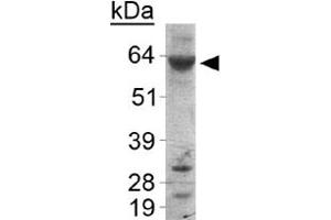 Western blot analysis of PLIN1 in human liver samples with PLIN1 polyclonal antibody . (PLIN1 antibody  (AA 450-522))