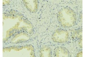 ABIN6278425 at 1/100 staining Mouse colon tissue by IHC-P. (ATP7A antibody  (C-Term))