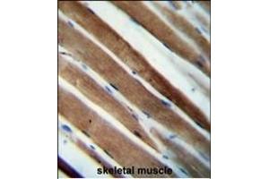 CCDC38 Antibody (Center) (ABIN654601 and ABIN2844300) immunohistochemistry analysis in formalin fixed and paraffin embedded human skeletal muscle followed by peroxidase conjugation of the secondary antibody and DAB staining. (CCDC38 antibody  (AA 352-380))