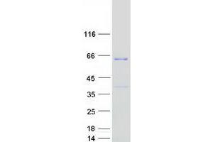 Western Blotting (WB) image for Family with Sequence Similarity 114, Member A2 (FAM114A2) protein (Myc-DYKDDDDK Tag) (ABIN2720732)