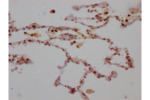 IHC image of ABIN7127313 diluted at 1:100 and staining in paraffin-embedded human lung tissue performed on a Leica BondTM system. (Recombinant ALOX5 antibody)