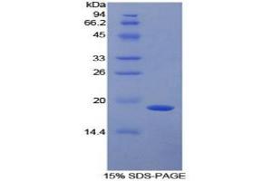 SDS-PAGE (SDS) image for Alpha2 Antiplasmin (SERPINF2) (AA 348-491) protein (His tag) (ABIN1878503)