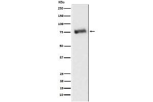 Western blot analysis of GRK3 expression in Ramos cell lysate.