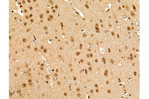 ABIN7094839 and ABIN7098890 at 1/100 staining Rat brain tissue by IHC-P.