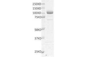 Recombinant LSD1 / KDM1A protein gel. (LSD1 Protein (DYKDDDDK Tag))