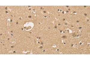Immunohistochemistry of paraffin-embedded Human brain using ALDH8A1 Polyclonal Antibody at dilution of 1:30 (ALDH8A1 antibody)