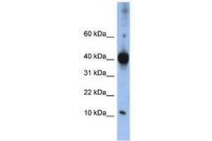 Image no. 1 for anti-LSM4 Homolog, U6 Small Nuclear RNA Associated (LSM4) (C-Term) antibody (ABIN6740691) (LSM4 antibody  (C-Term))