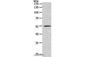 Western blot analysis of K562 cell, using PAX1 Polyclonal Antibody at dilution of 1:1200 (PAX1 antibody)